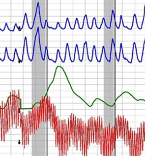 Arcadia polygraph examination